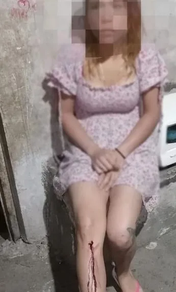 Mujere Herida Oxxo - El Día De Michoacán