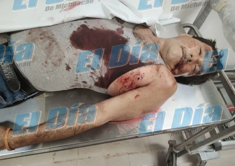 Lo Hieren De Varios Disparos En La Plaza De Cupuán Del Río Y Fallece En El Hospital De Múgica