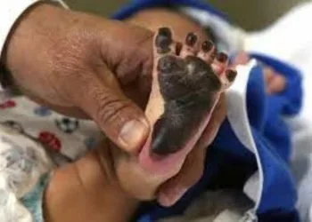 Estos Son Los Peligros De Dejar A Niñas Y Niños Dentro Del Auto