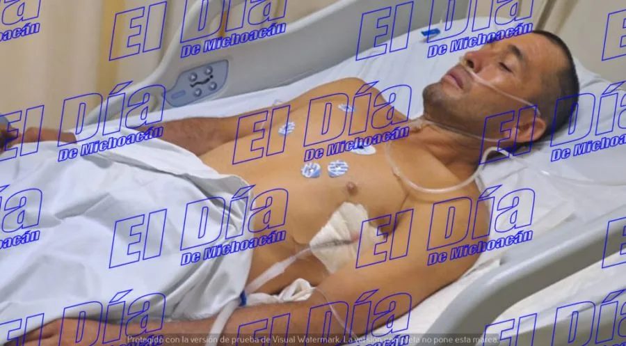 Cortador De Limón Es Baleado Por Un Compañero De Trabajo En Parácuaro