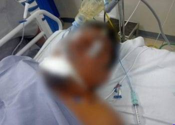 Le cae un rayo a cortador de limón en una parcela de la Presa del Rosario; esta delicado