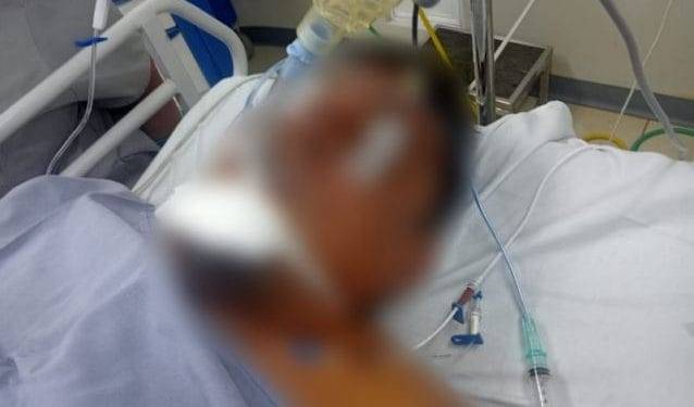 Le cae un rayo a cortador de limón en una parcela de la Presa del Rosario; esta delicado