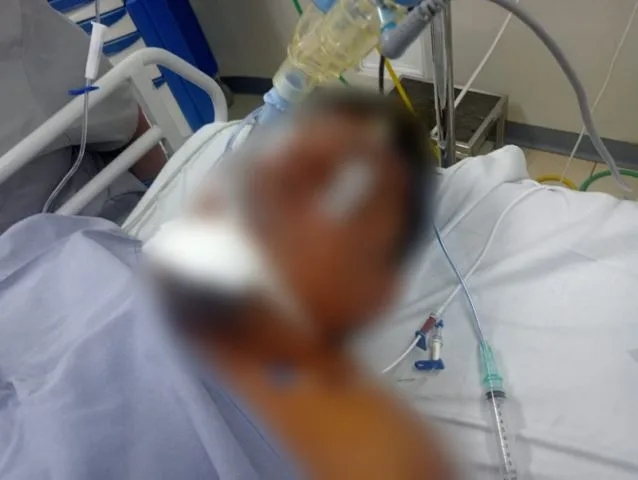 Le Cae Un Rayo A Cortador De Limón En Una Parcela De La Presa Del Rosario; Esta Delicado