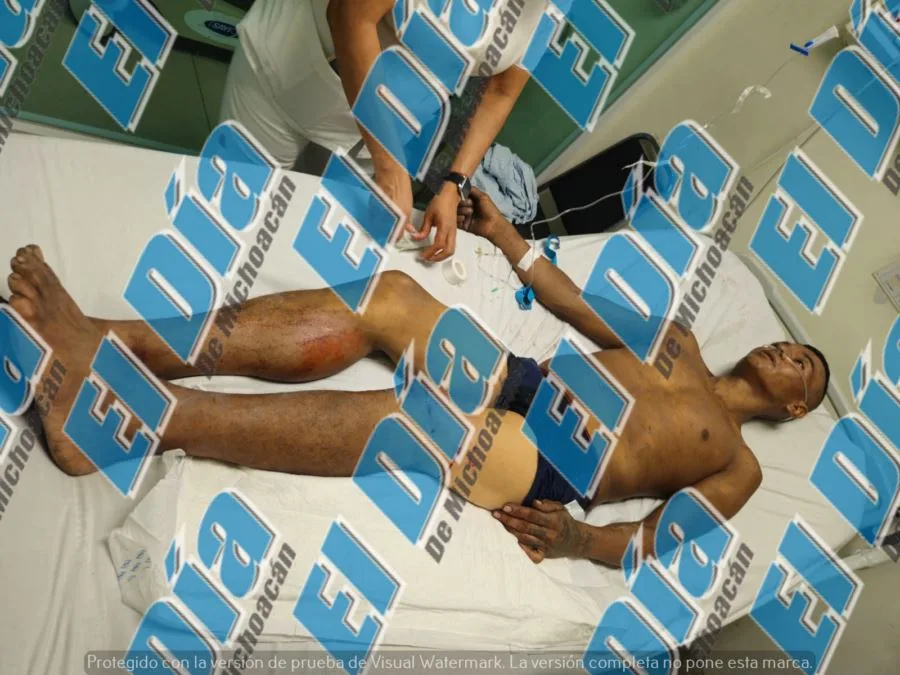 Le Dan Varios Disparos A Presunto Ladrón De Cable En La 22 De Octubre De Apatzingán 20 Le Dan Varios Disparos A Presunto Ladrón De Cable En La 22 De Octubre De Apatzingán