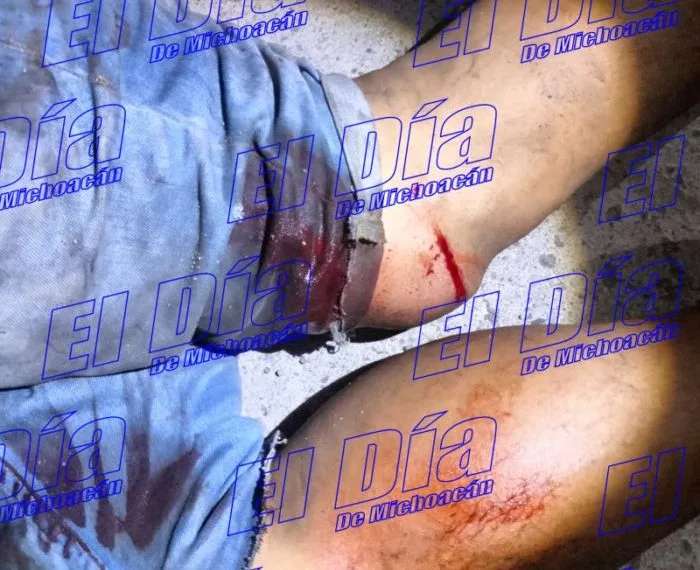 Le Dan Varios Disparos A Presunto Ladrón De Cable En La 22 De Octubre De Apatzingán 19 Le Dan Varios Disparos A Presunto Ladrón De Cable En La 22 De Octubre De Apatzingán