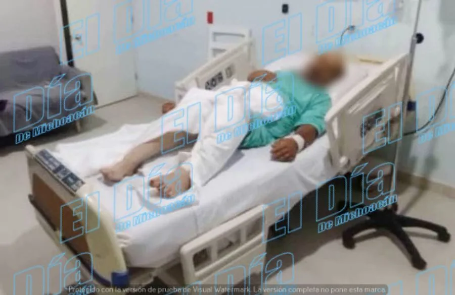 Grave Tras Explotarle Mina En Camino De Buenavista