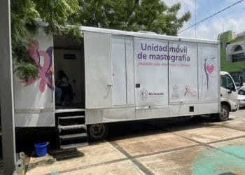 El mastógrafo recorrerá poblados de esta región: EV