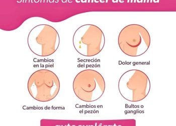 Los Sintomas Del Cancer De Mama - El Día De Michoacán