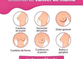 Reconoce Los Síntomas Del Cáncer De Mama Para Actuar De Inmediato
