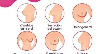 Los Sintomas Del Cancer De Mama - El Día De Michoacán