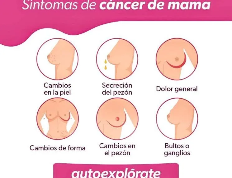 Reconoce Los Síntomas Del Cáncer De Mama Para Actuar De Inmediato