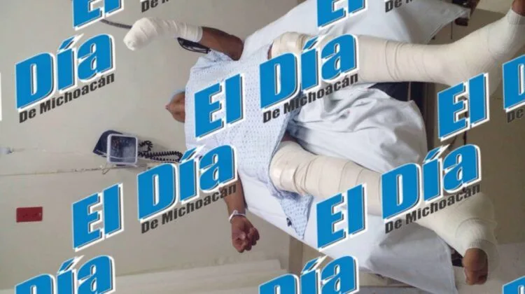 Lo Hieren Con Arma De Fuego Y Lo Despojan De Sus Pertenencias En La Palmira De Apatzingán 21 Garantizar El Trato Digno De Personas No Identificadas, Un Deber: Als