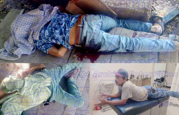 Dos Muertos Y Un Herido Dejó El Saldo De Una Agresión Armada A Albañiles En Buenavista