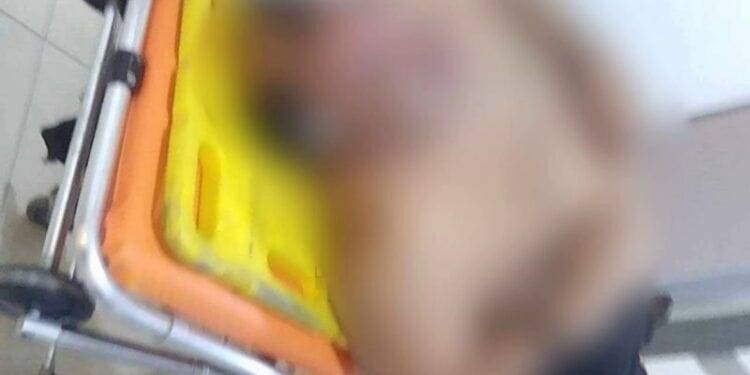 Paramédicos de Protección Civil auxilian a taxista en Apatzingán golpeado tras ser robado