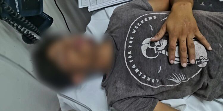 En La Pénjamo De Apatzingán, Rivales En Amores Pelean Y Uno Ataca A Otro Con Desarmador Y Gas Pimienta