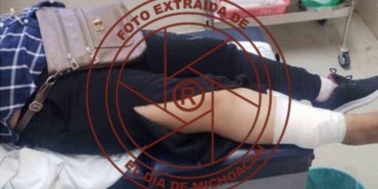 Una lesionada más por disparos de arma de fuego llega al Hospital de Buenavista