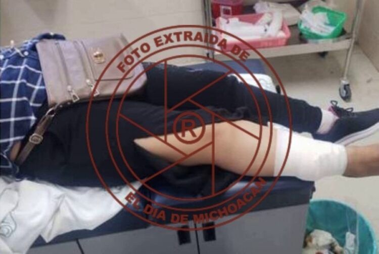 Una Lesionada Más Por Disparos De Arma De Fuego Llega Al Hospital De Buenavista