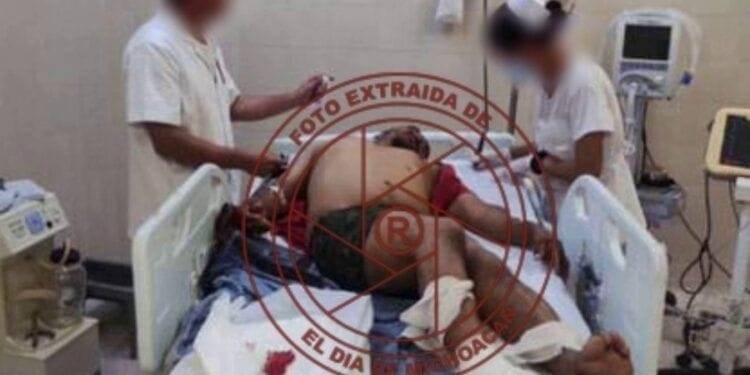 Llega herido por disparos de arma al Hospital IMSS Bienestar de Buenavista