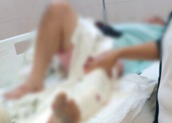 En Buenavista, Se Lesiona Al Manipular Arma Prestada