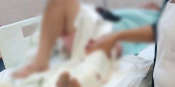 En Buenavista, Se Lesiona Al Manipular Arma Prestada 23 En Buenavista, Se Lesiona Al Manipular Arma Prestada