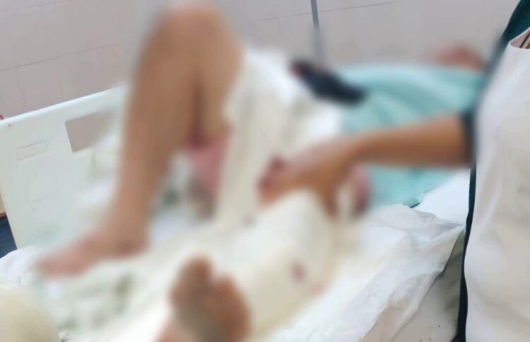 En Buenavista, Se Lesiona Al Manipular Arma Prestada