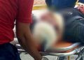 Joven Resulta Herido Al Derrapar En Una Motocicleta En Apatzingán 31 Joven Resulta Herido Al Derrapar En Una Motocicleta En Apatzingán