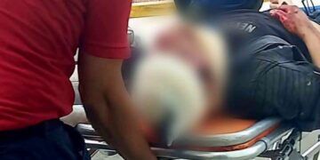 Joven Resulta Herido Al Derrapar En Una Motocicleta En Apatzingán