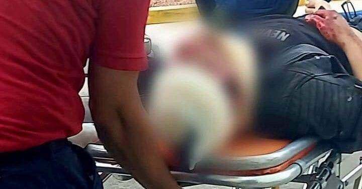 Joven resulta herido al derrapar en una motocicleta en Apatzingán 1 Joven resulta herido al derrapar en una motocicleta en Apatzingán