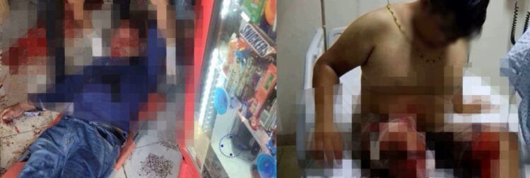 Muere Segundo Lesionado En Una Tienda De Abarrotes Cercana A La Hora Azul De Apatzingán 23 Hugo Molina Continúa Atendiendo A La Población Que Acude A Palacio Municipal