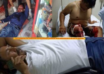 Vacunación Contra La Influenza Hasta El 31 De Marzo: Ssm