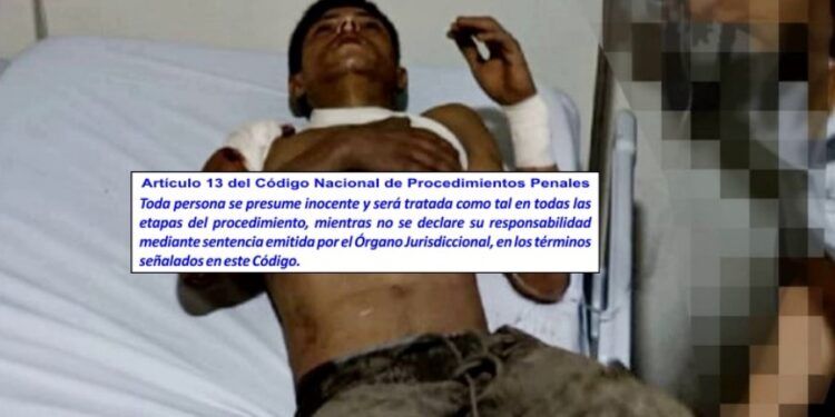 Agreden a balazos a elementos de la DEFENSA y Guardia Nacional: dejando el saldo de dos agresores sin vida y un herido