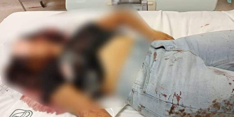 Delincuentes disparan contra policías y en otro ataque balean a 2 jóvenes y a una bebé, en Buenavista