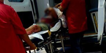 Adolescente Resulta Herido Al Derrapar Su Motocicleta