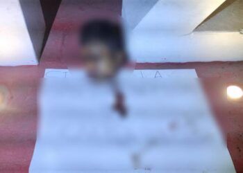 Adolescente Resulta Herido Al Derrapar Su Motocicleta