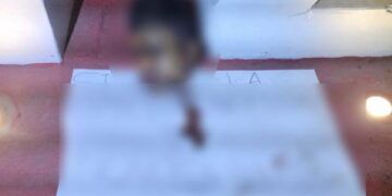 Adolescente Resulta Herido Al Derrapar Su Motocicleta