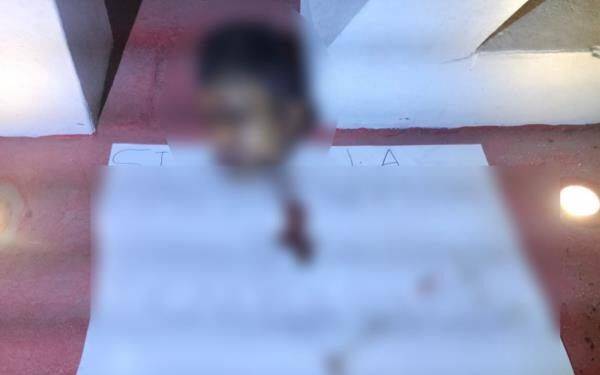 Dejan cabeza humana en el letrero de APATZINGAN 1 Adolescente resulta herido al derrapar su motocicleta