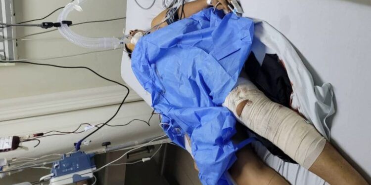 Muere Venezolana al intentar emboscar a DEFENSA y Guardia Civil en Rancho California de Apatzingán