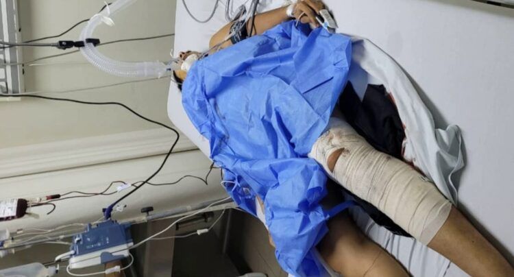 Muere Venezolana Al Intentar Emboscar A Defensa Y Guardia Civil En Rancho California De Apatzingán