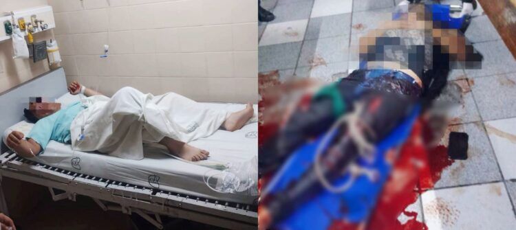 Vinculan A Proceso A José Alonso “N”, Presunto Responsable De Tentativa De Feminicidio, En Zitácuaro