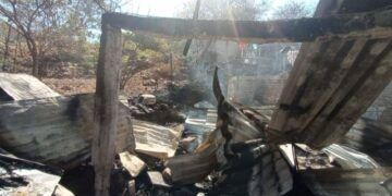 Adolescente Resulta Herido Al Derrapar Su Motocicleta