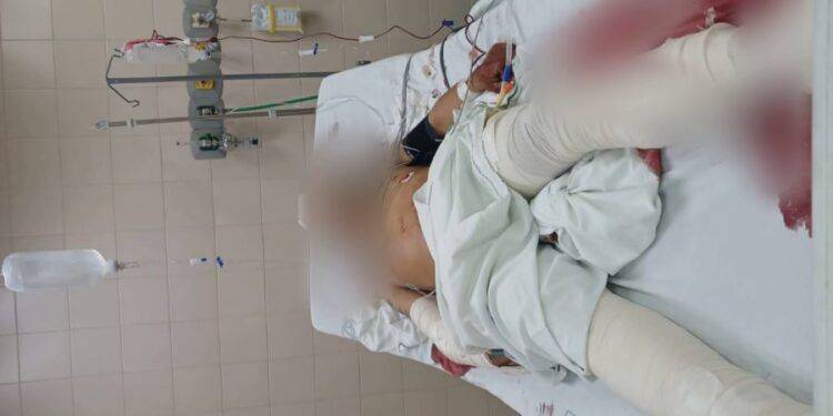 Muere joven tras ser baleado en La Ruana 1 Muere joven tras ser baleado en La Ruana