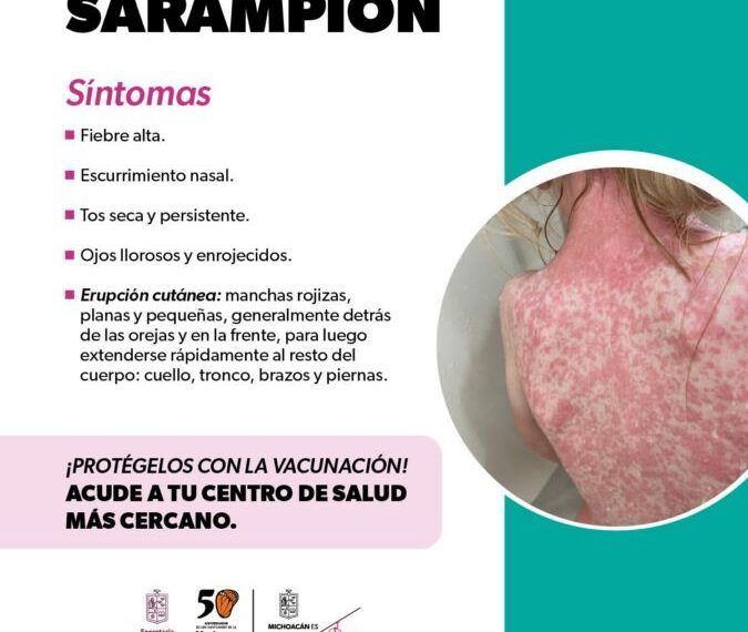 Sarampion | El Día de Michoacán