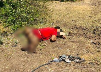 Identifica Los Síntomas Del Sarampión Y Protege Tu Salud: Ssm