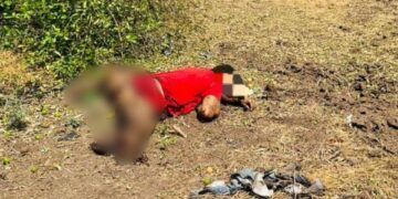 Identifica Los Síntomas Del Sarampión Y Protege Tu Salud: Ssm