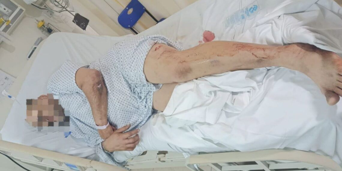 trailero herido en Apatzingan | El Día de Michoacán