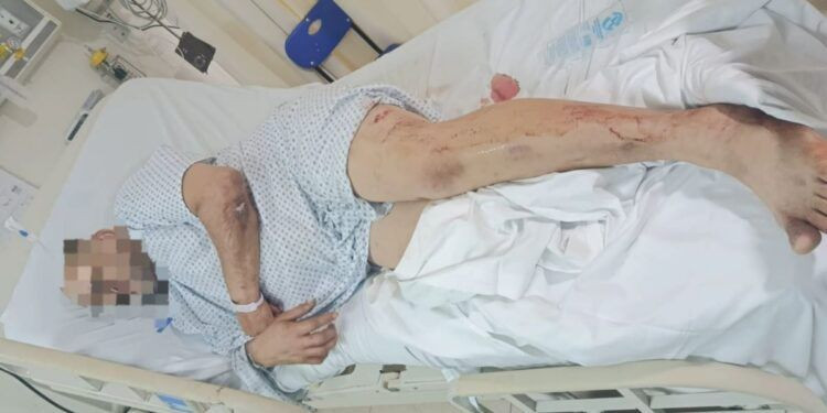 Hieren a balazos a un trailero tras intento de robo de motocicleta en Apatzingán 1 Ninguna escuela de Michoacán se encuentra en paro: Bedolla