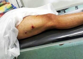 Ataca A Su Madre A Balazos En Cupuán Del Río; Queda Herida