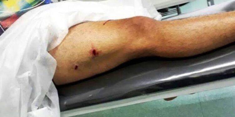 Ataca a su madre a balazos en Cupuán del Río; queda herida 1 Ataca a su madre a balazos en Cupuán del Río; queda herida