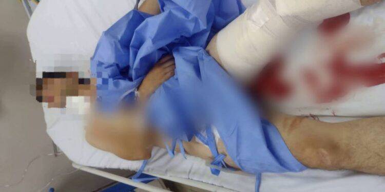 Balean a joven en Apatzingán; lucha por su vida 1 Vinculado a proceso a responsable de homicidio de un albañil, cometido en Coalcomán
