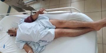 ¿Conoces La Nueva Boleta Para Primarias? See La Explica